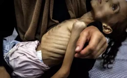 İnsanlığı utandıracak görüntüler! Gazzeli Meryem yavaş yavaş ölüyor