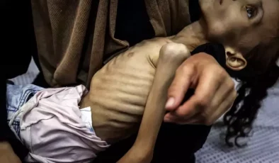 İnsanlığı utandıracak görüntüler! Gazzeli Meryem yavaş yavaş ölüyor